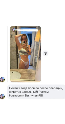 Увеличение груди