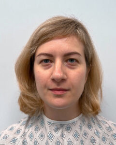 Блефаропластика и эндоскопический лифтинг - до