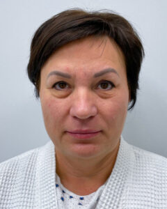 Эндоскопический лифтинг с круговой блефаропластикой - до