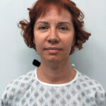 Тотальное омоложение - до