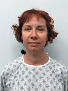 Тотальное омоложение - до