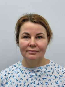 Эндоскопический лифтинг в сочетании блефаропластикой - до