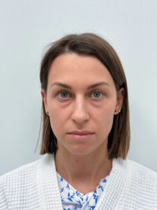 Трансконъюнктивальная блефаропластика - до