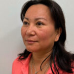 Верхняя блефаропластика - после