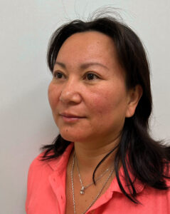 Верхняя блефаропластика - после