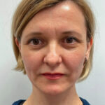 Верхняя блефаропластика - после