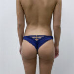 Липосакция - после