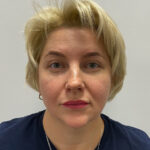 Круговая блефаропластика - после