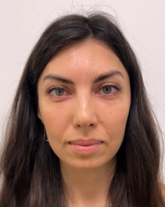 Круговая блефаропластика - после