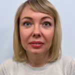 Круговая блефаропластика - после