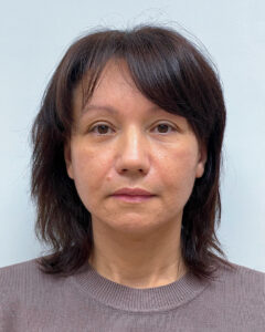 СМАС лифтинг - после