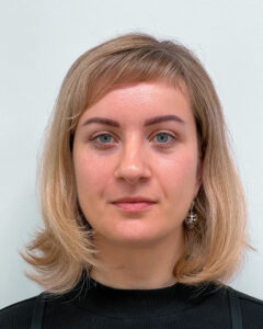 Блефаропластика и эндоскопический лифтинг - после