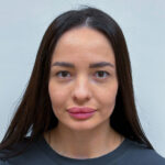 Трансконъюнктивальная блефаропластика - после