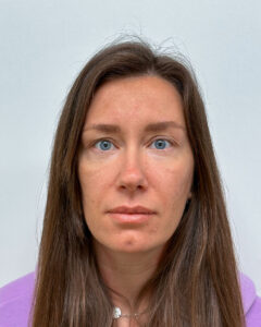 Трансконъюнктивальная блефаропластика - после