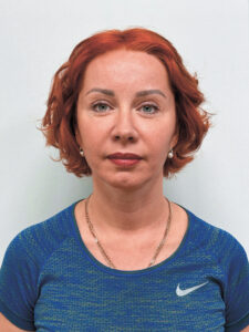 Тотальное омоложение - после