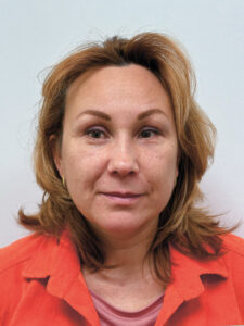 Эндоскопический лифтинг в сочетании блефаропластикой - после