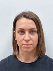 Трансконъюнктивальная блефаропластика - после