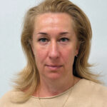 Эндоскопический лифтинг + круговая блефаропластика - после