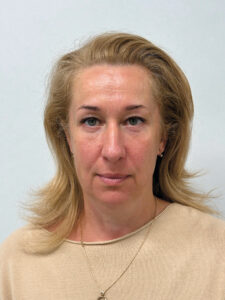 Эндоскопический лифтинг + круговая блефаропластика - после